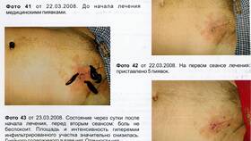 Почему умирают пиявки в банке в Связной